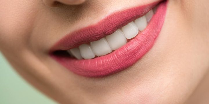 Why Dental Implants Are Replacing Traditional Tooth Fixes